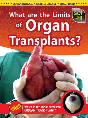 cover image of What Are the Limits of Organ Transplantation?